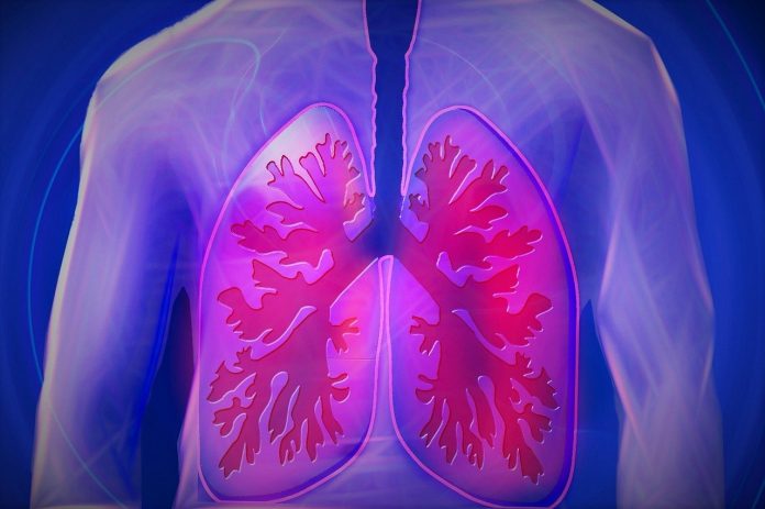tuberculosis_pulmonar